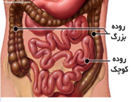 علل و درمان گرفتگی روده