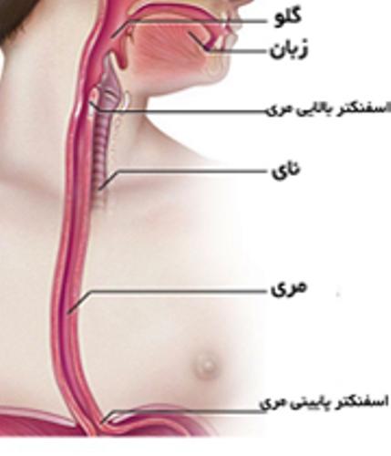 عضلات مری هم می گیرند عضلات مری هم می گیرند