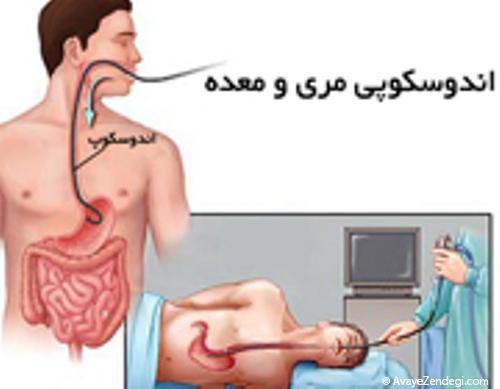 عضلات مری هم می گیرند عضلات مری هم می گیرند