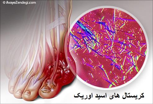 درد شست پا نشانه چیست؟