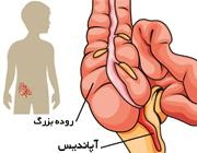  علائم عفونت آپاندیس در کودکان 