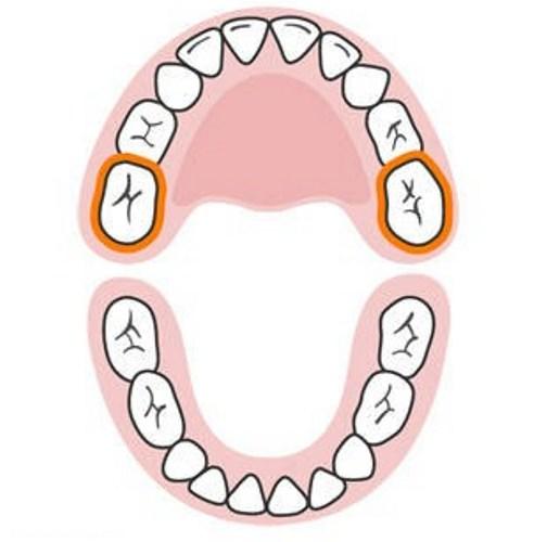  ترتیب رشد دندان های کودک 