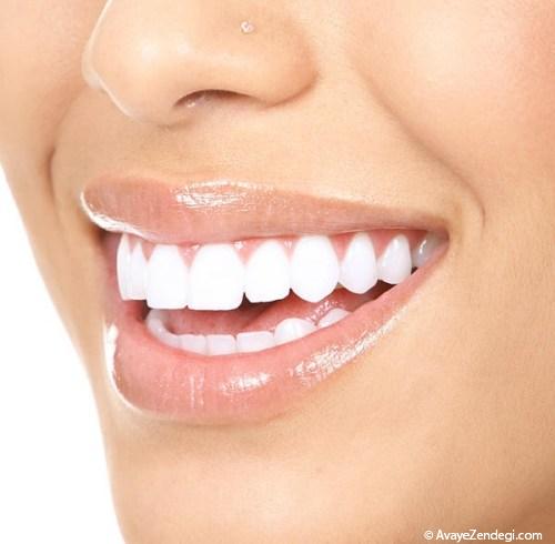 چگونه دندان‌های سفید داشته باشیم؟