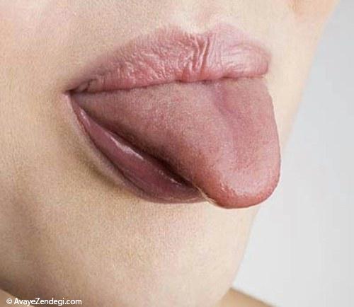  15 نشانه اینکه فقر آهن دارید 