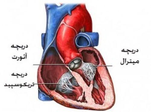 علل بیماری‌ دریچه‌ قلب‌ و درمان آن