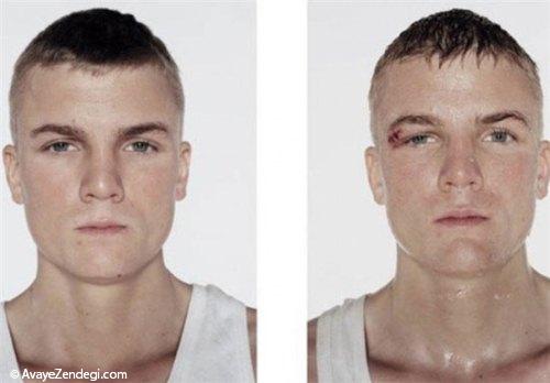  بوکسورهای جوان قبل و بعد از مبارزه 