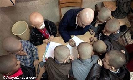 اندر فواید کچل کردن در دوران سرتراشی! اندر فواید کچل کردن در دوران سرتراشی!