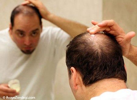 ویتامین های ضروری برای رشد و تقویت مو در آقایان
