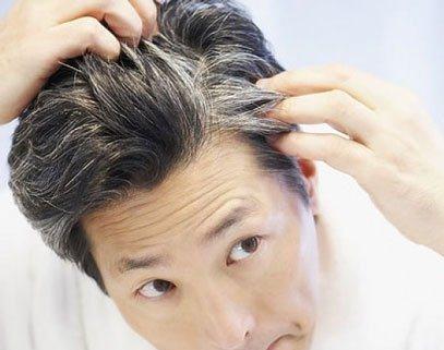  راهکارهای سنتی علیه سفید شدن موها 