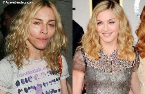  هنرمندان معروف قبل و بعد از آرایش 