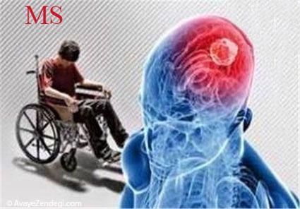ام اس؛ وحشت دنیای مدرن ام اس؛ وحشت دنیای مدرن