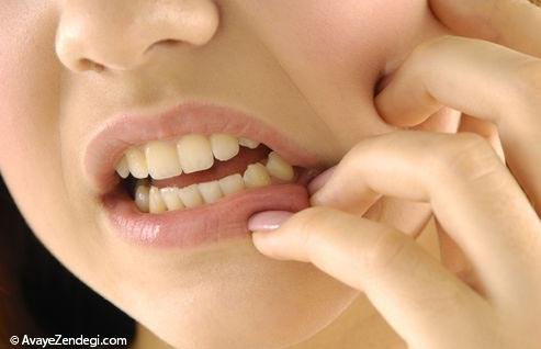 8 باور نادرست دندانی