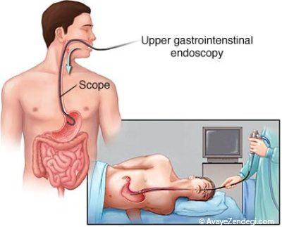 آندوسکوپی خطری ندارد