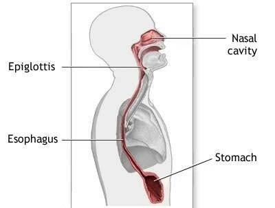 از بیماری مری بارت (Barrett’s esophagus) چه میدانید؟