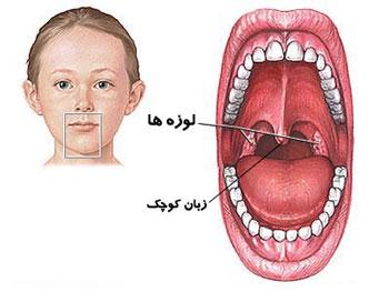  چرا زبان کوچک،بزرگ می شود؟ 