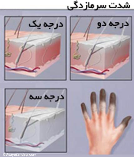 گزش بدن توسط سرما