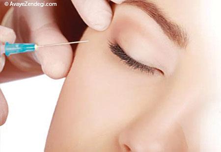 طب سوزنی به جای بوتاكس؟ طب سوزنی به جای بوتاكس؟