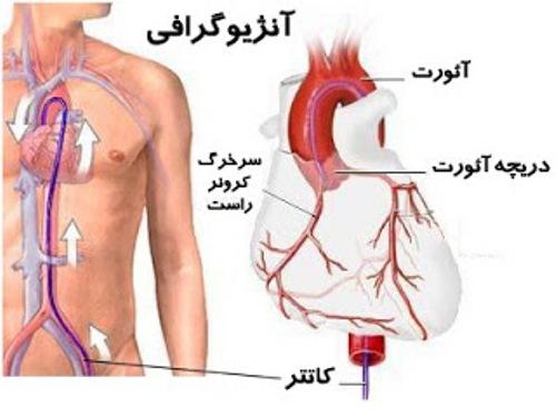 10 ابزار تشخیصی بیماری قلبی