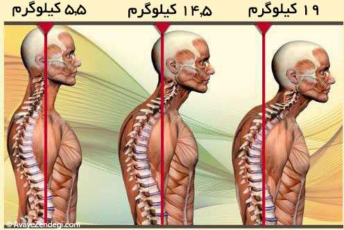 بیماری گردن پیامکی نگیرید