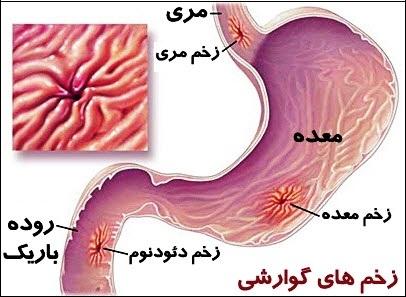 5 بیماری که آقایان باید بشناسند