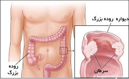 5 بیماری که آقایان باید بشناسند