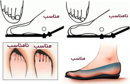 نحوه خرید کفشی که پایتان را نزند