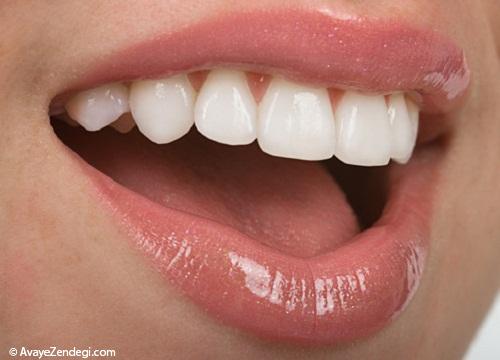 ویتامین پیشگیری از پوسیدگی دندان