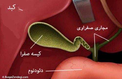 چرا صفرا راهش را گم می‌کند؟