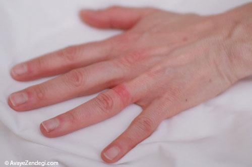 10 نکته درباره حساسیت پوستی به زیورآلات 10 نکته درباره حساسیت پوستی به زیورآلات