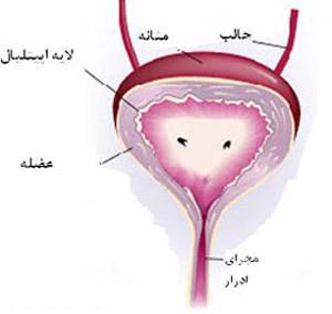 التهاب مثانه (سیستیت) چیست؟