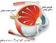  رابطه گربه و سوسک با آب سیاه چشم 