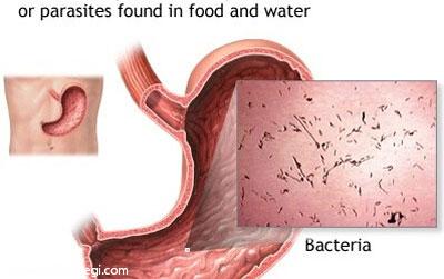 میکروب معده چیست؟
