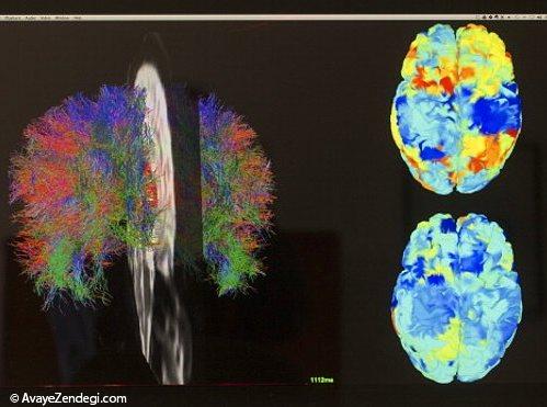  43 حقیقت جالب درباره مغز انسان که نمی دانستید! (1) 